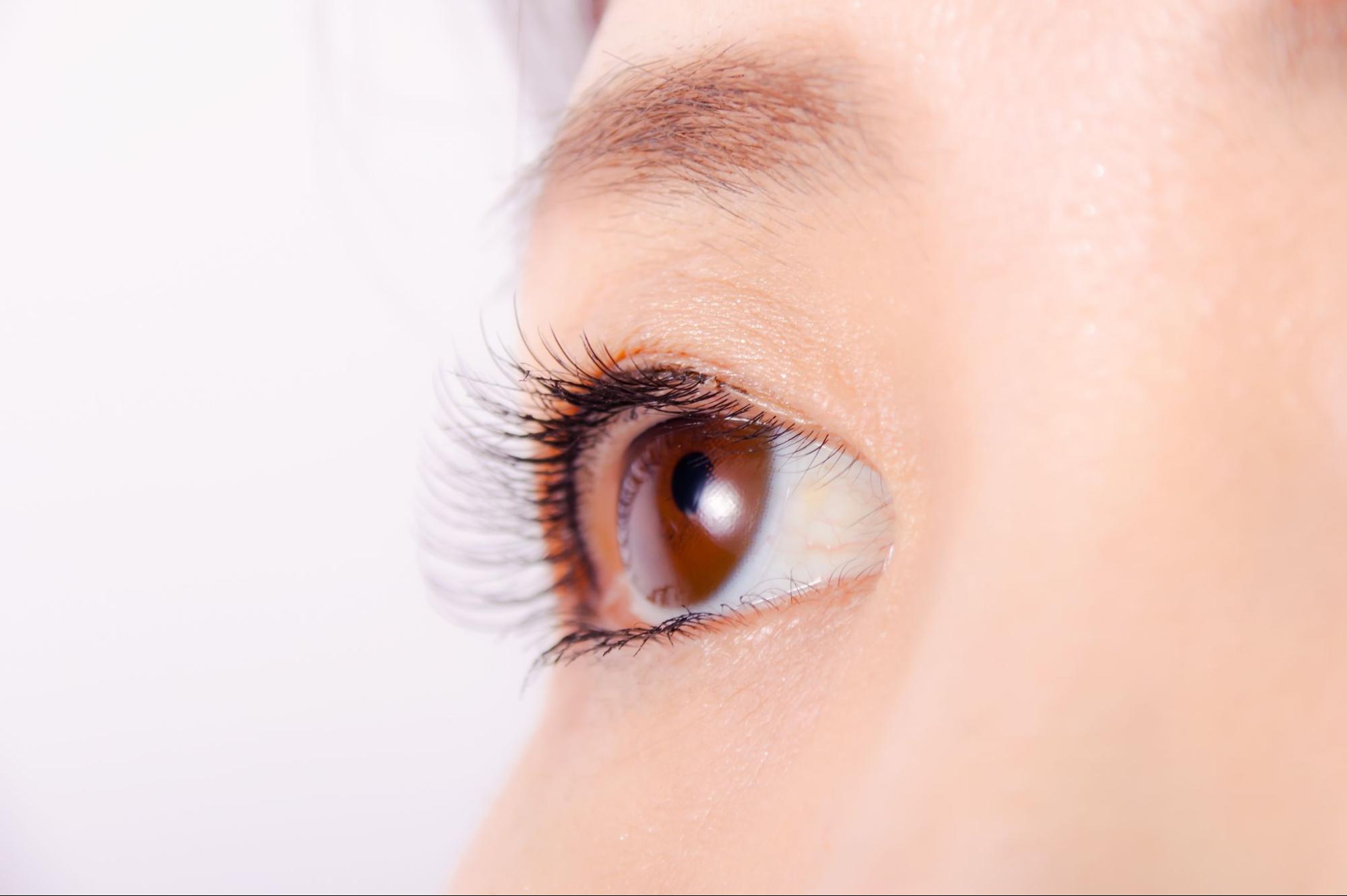 先天性眼瞼下垂の8割は片目だけに起こる